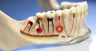 Endodontics